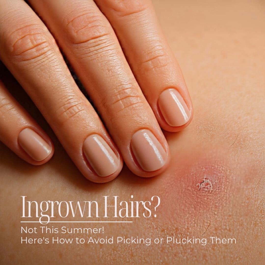 Ingrown Hairs? Not This Summer! Here's How to Avoid Picking or Plucking Them